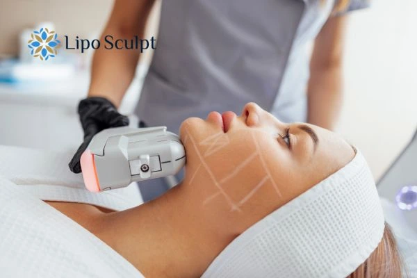 HIFU vs Botulinum Toxin: Understanding the Differences 1 HIFU vs Botox Herne What is the best option for you?