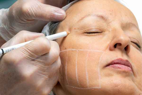 CryoPen: 5 Skin Concerns It May Be Used to Treat 4 What should you ask before having CryoPen treatment Herne?